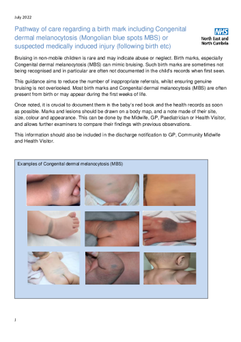 08 Pathway of care regarding a birth mark including Congenital dermal melanocytosis or mediaclly induced injury